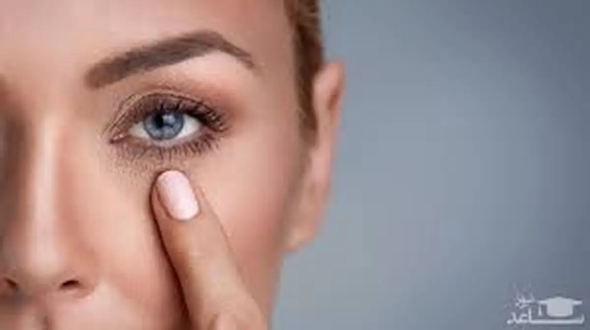 چرا زیر چشم‌ها تیره می‌شود؟