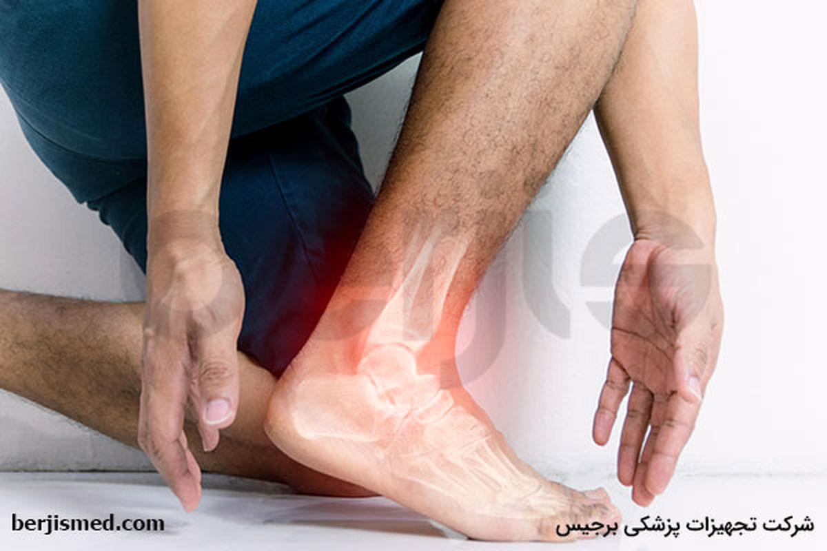 درمان آرتروز مچ پا با استفاده از فیزیوتراپی