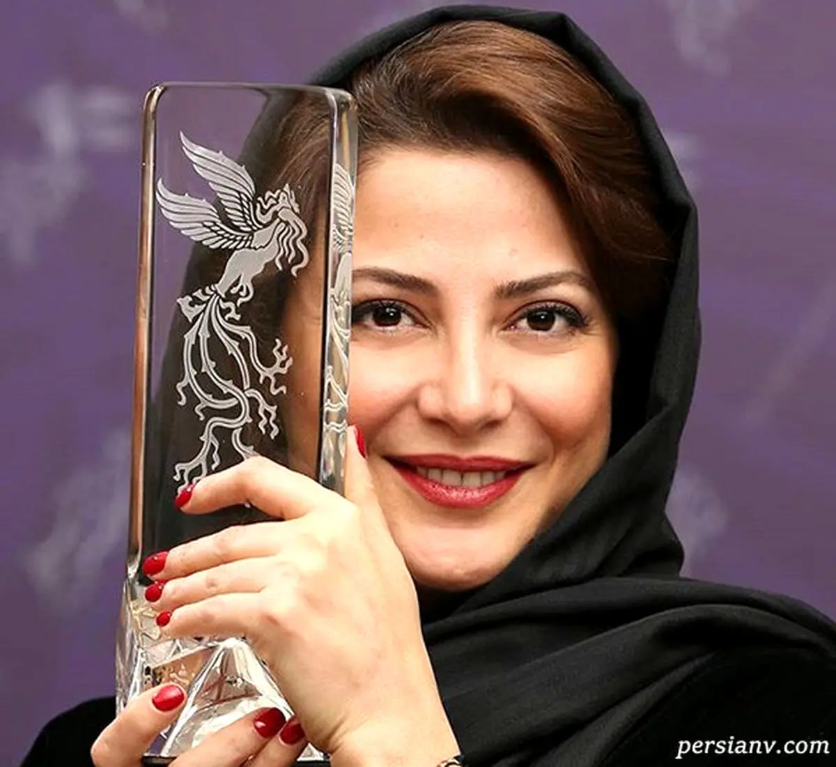 تغییرات وحشتناک طناز طباطبایی | چه بلایی بر سر طناز طباطبایی آمده است