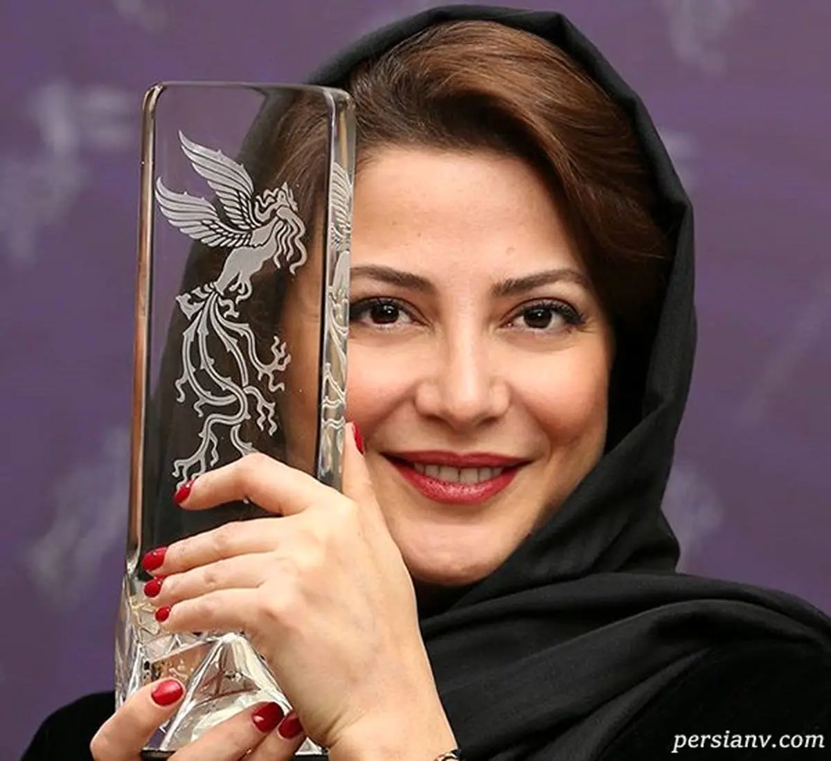 تغییرات وحشتناک طناز طباطبایی | چه بلایی بر سر طناز طباطبایی آمده است