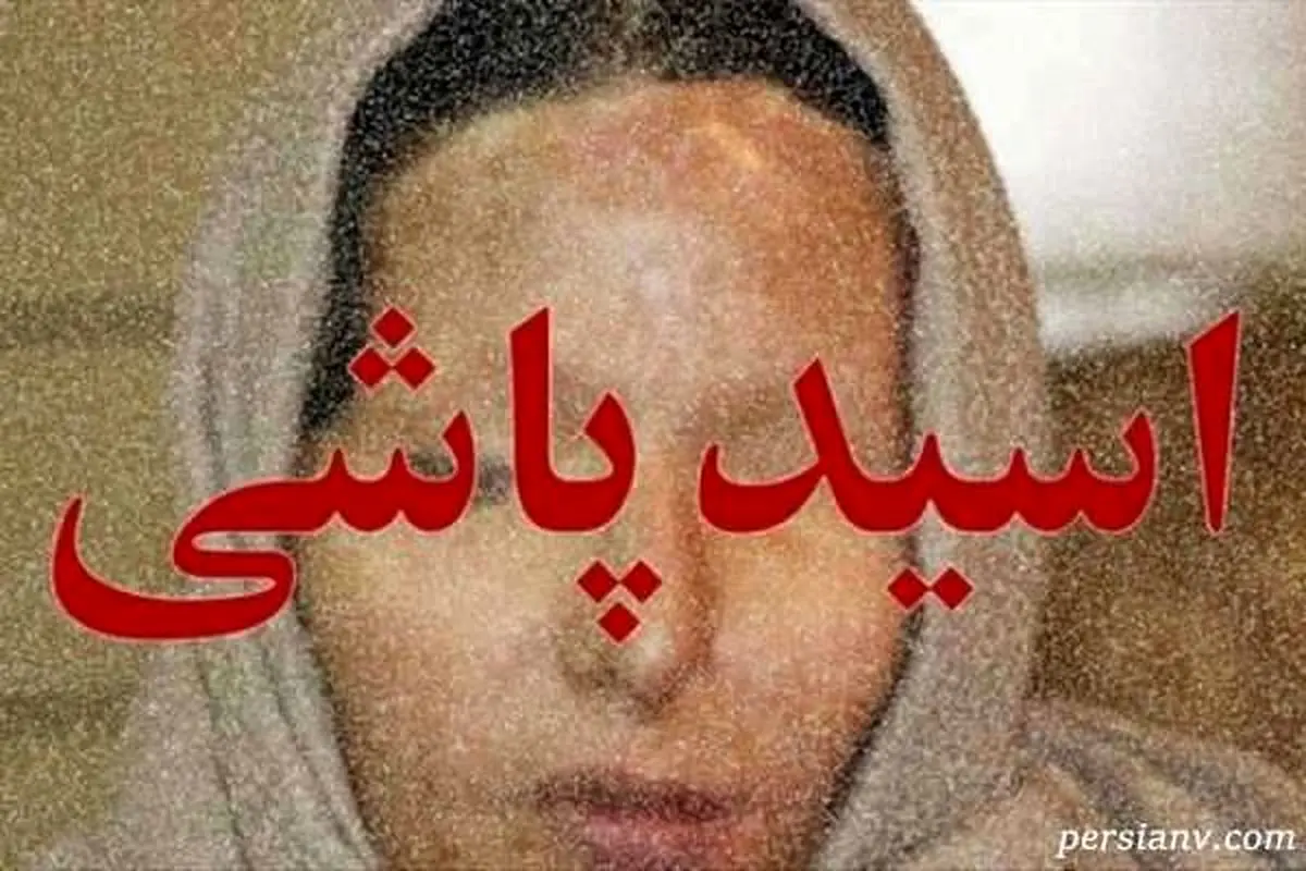 دختر قربانی اسیدپاشی از زندگی تلخ و دردناکش می گوید