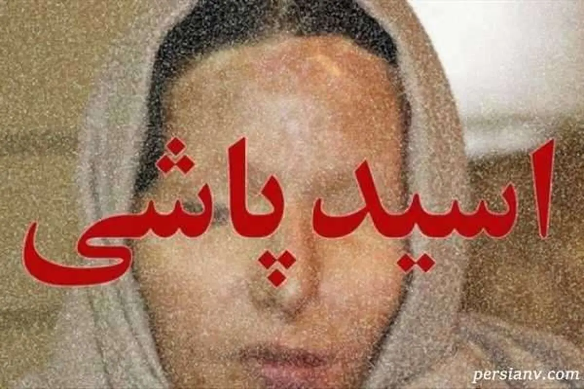 دختر قربانی اسیدپاشی از زندگی تلخ و دردناکش می گوید