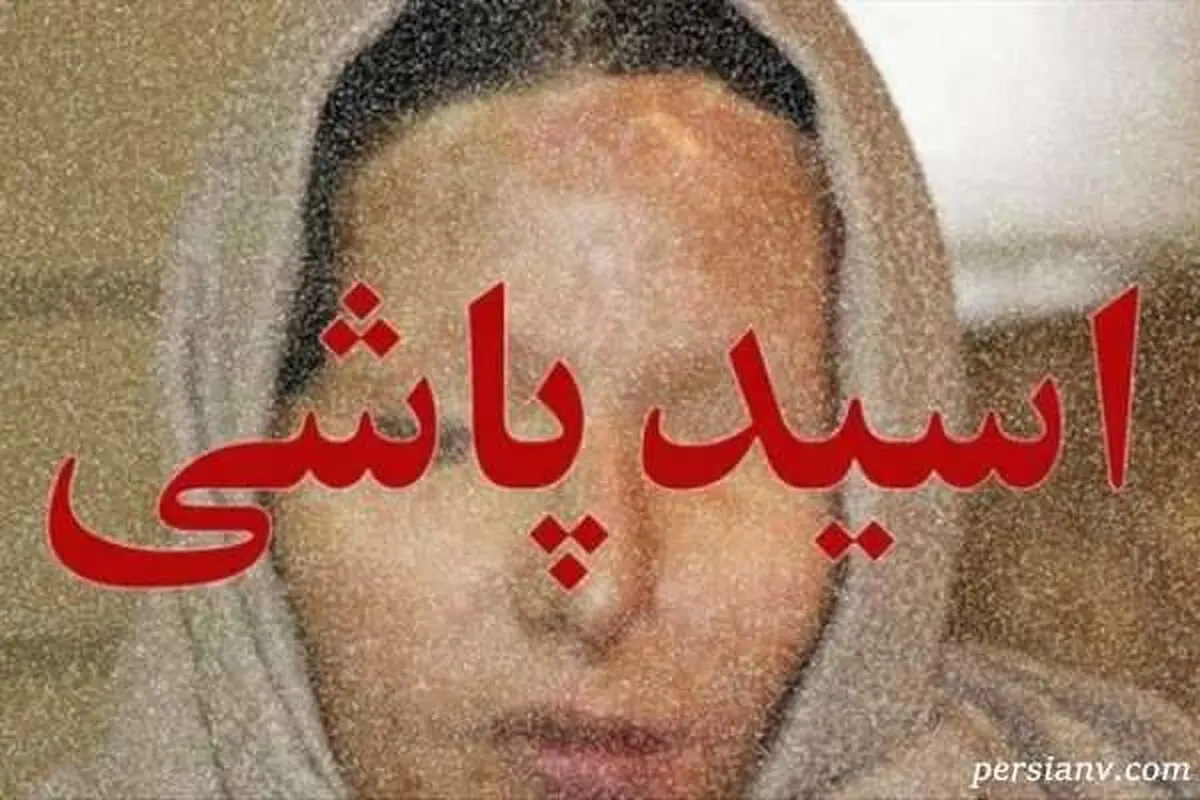 دختر قربانی اسیدپاشی از زندگی تلخ و دردناکش می گوید