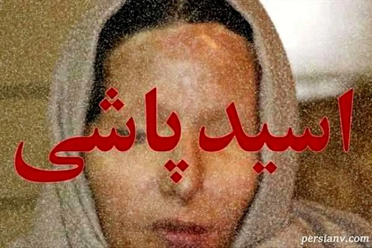 دختر قربانی اسیدپاشی از زندگی تلخ و دردناکش می گوید