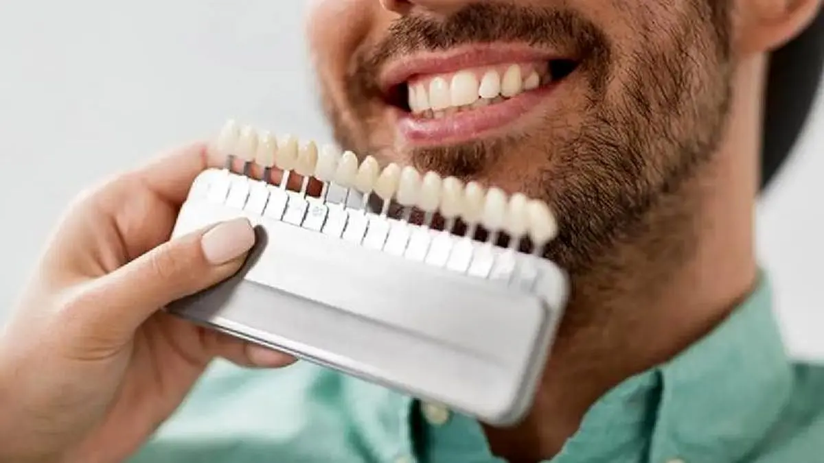 روش‌های نوین زیباسازی دندانی که در تهران باب شده است

