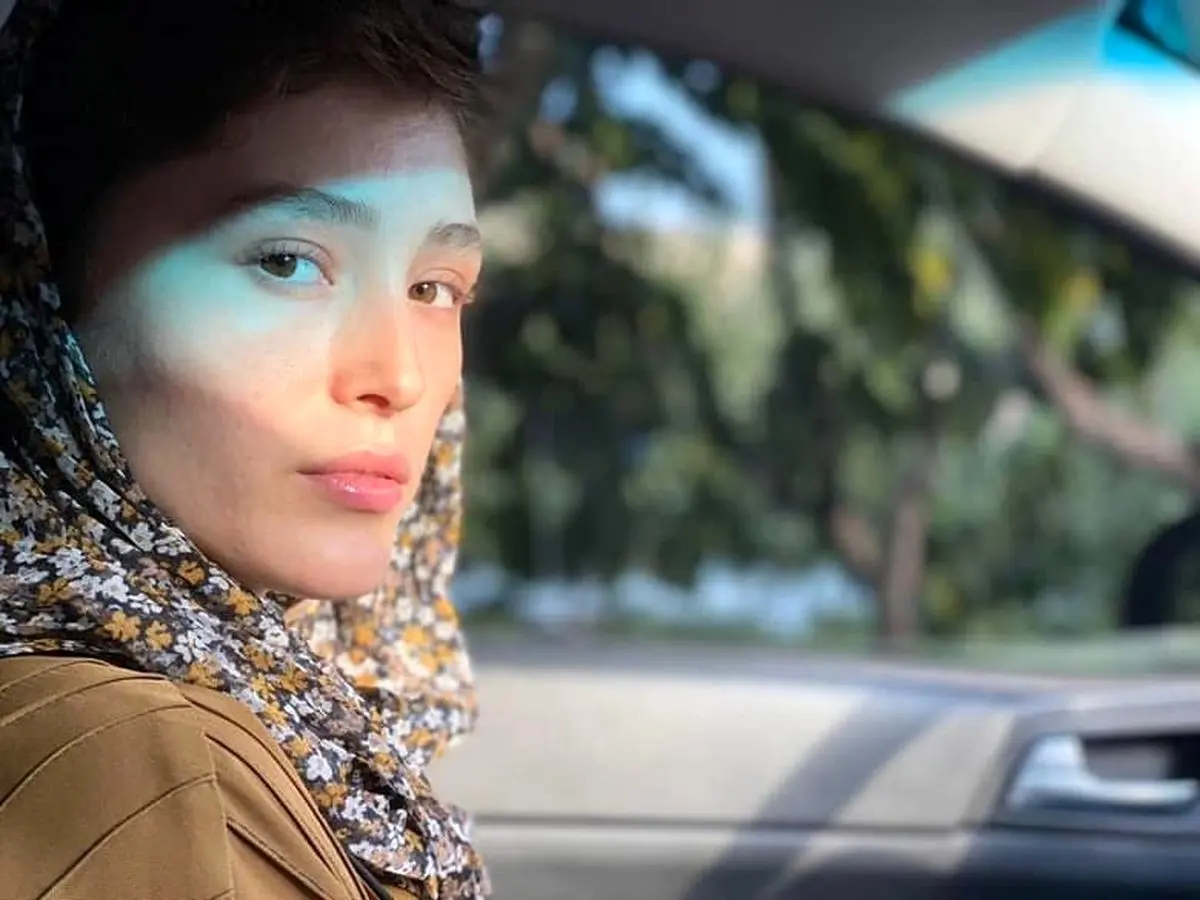 عکس چهره خونین فرشته حسینی ! | لایو تکان دهنده زن نوید محمدزاده همه را شوکه کرد