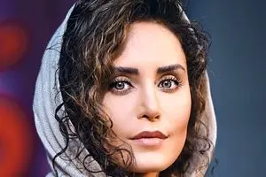چهره عجیب الناز شاکردوست بعد از جراحی زیبایی | الناز شاکردوست با این حرکت حسابی سوژه شد