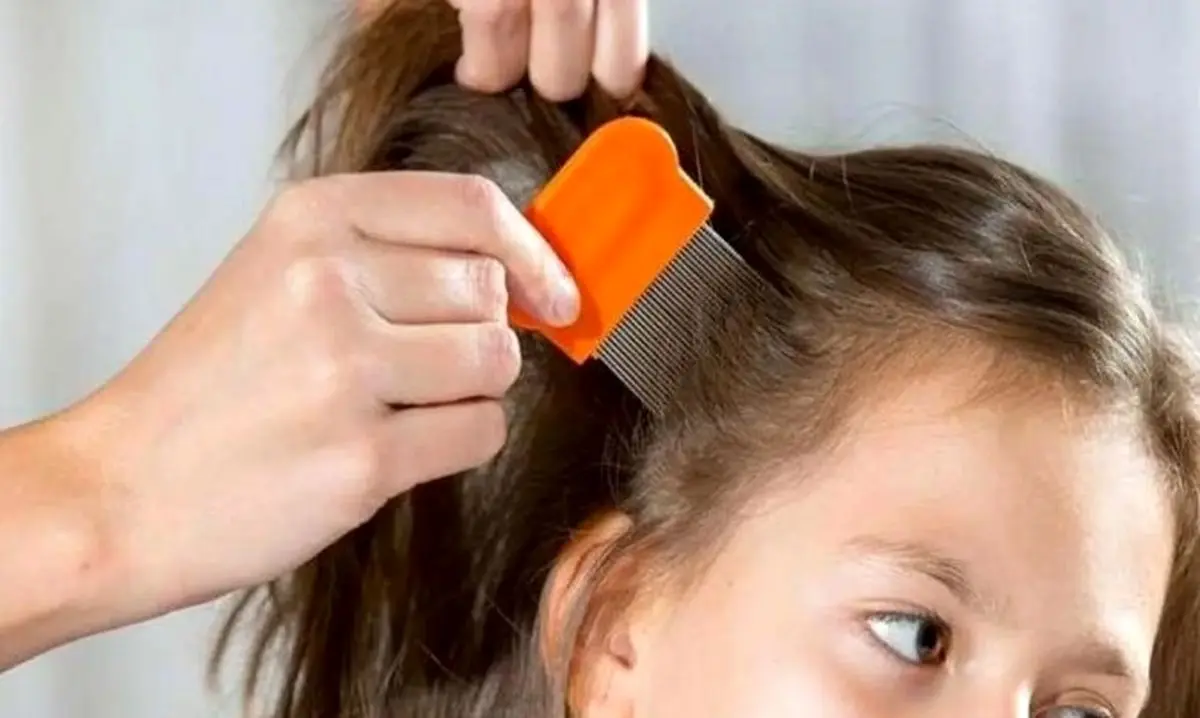 شپش در مدرسه؟ نگران نباشید! | درمان‌های خونگی و فوری برای نجات بچه مدرسه‌ای‌ها 