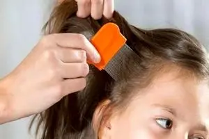 شپش در مدرسه؟ نگران نباشید! | درمان‌های خونگی و فوری برای نجات بچه مدرسه‌ای‌ها 