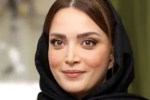 ویدئوی زیرخاکی از بهنوش طباطبایی | تغییر شگفت‌انگیز خانم بازیگر بعد از عمل زیبایی