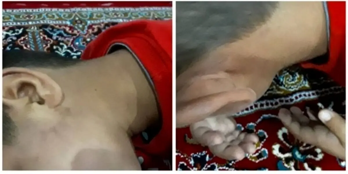 شکنجه دانش آموز کلاس اول توسط معلم