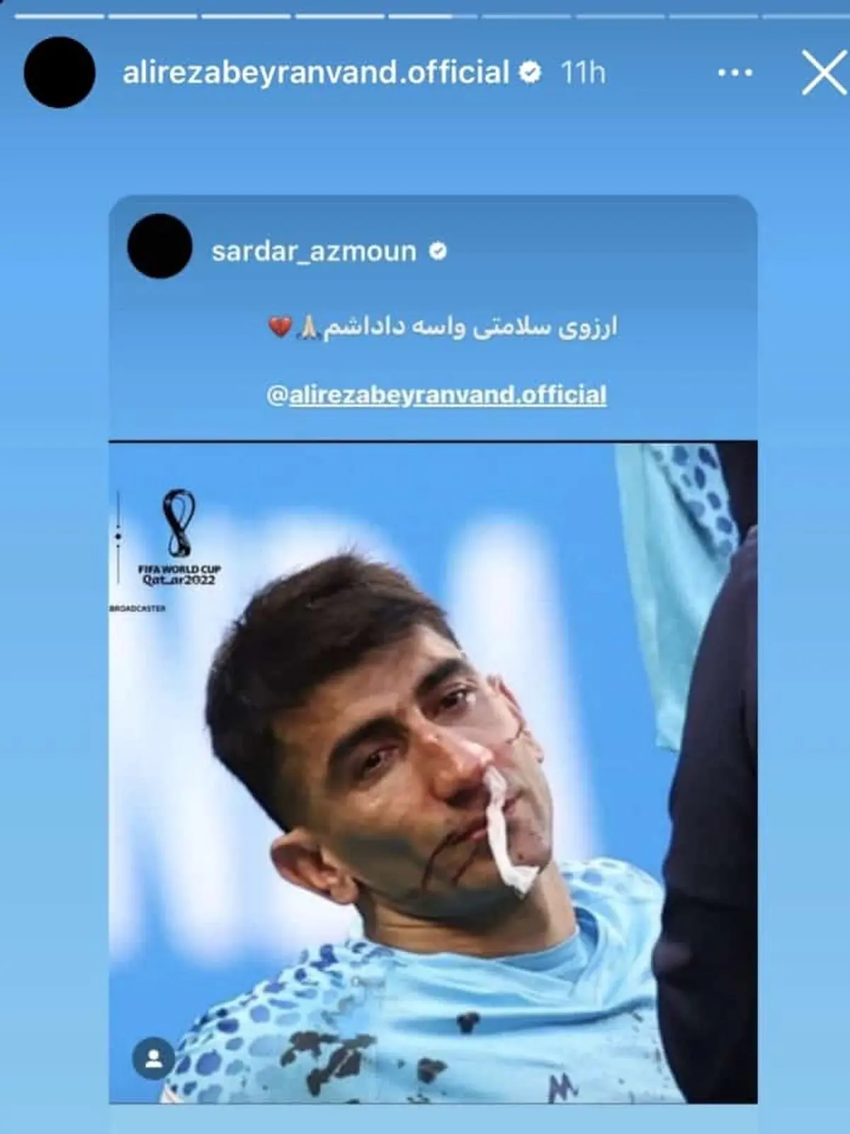 صحنه غم انگیز بازی فوتبال دیروز ایران و انگلستان