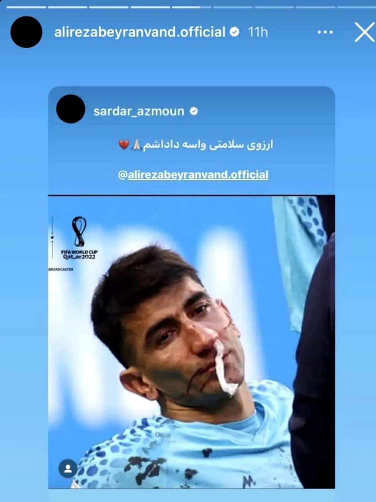 صحنه غم انگیز بازی فوتبال دیروز ایران و انگلستان