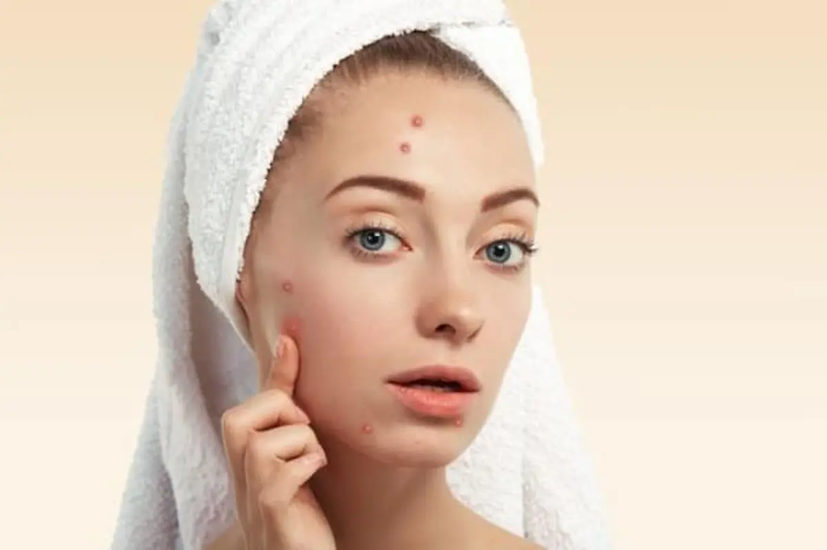 این میوه رو مصرف کنید تا دیگه جوش نزنین