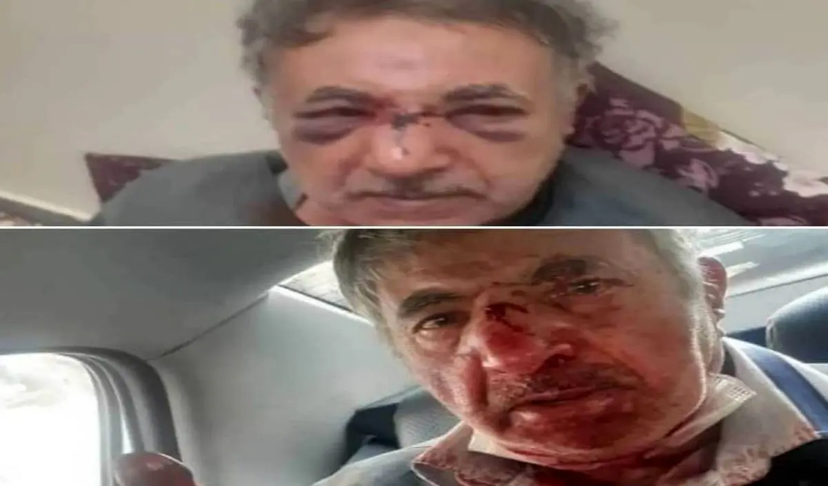 توضیح شهرداری تبریز درباره ضرب و شتم یک شهروند