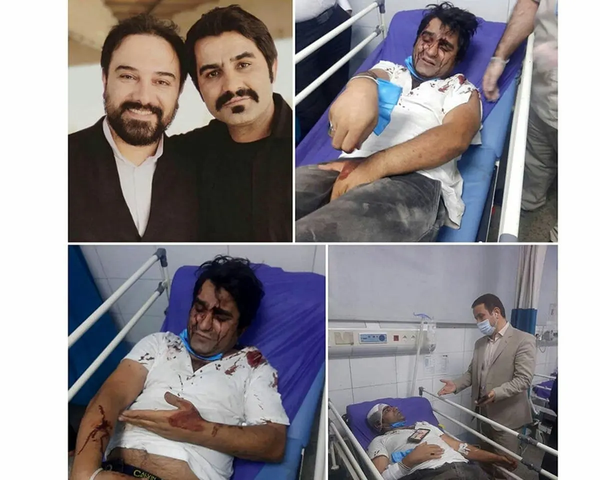 حمله خونین به 2 بازیگر سریال دودکش 