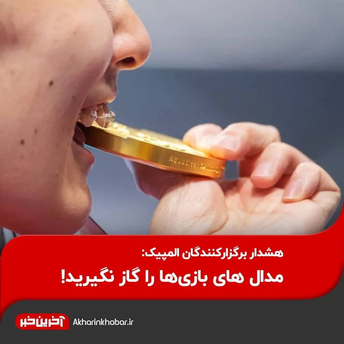  مدال های بازی‌ها را گاز نگیرید!
