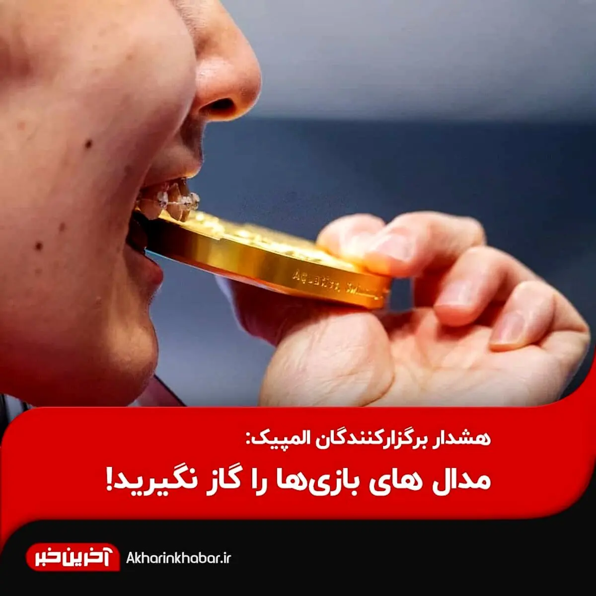  مدال های بازی‌ها را گاز نگیرید!
