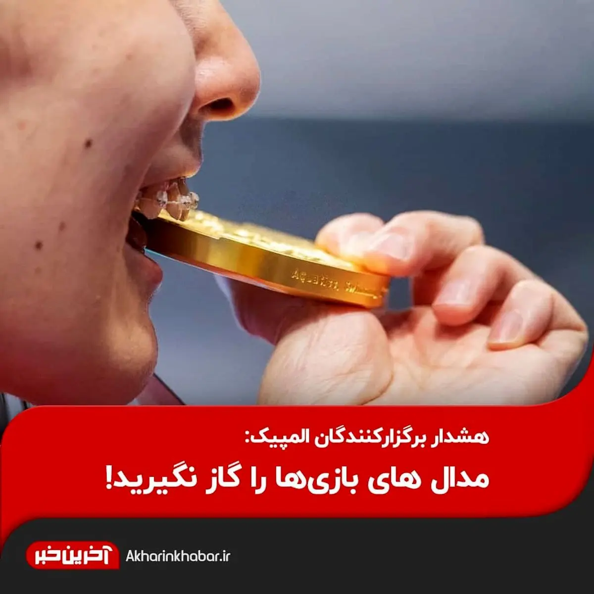  مدال های بازی‌ها را گاز نگیرید!
