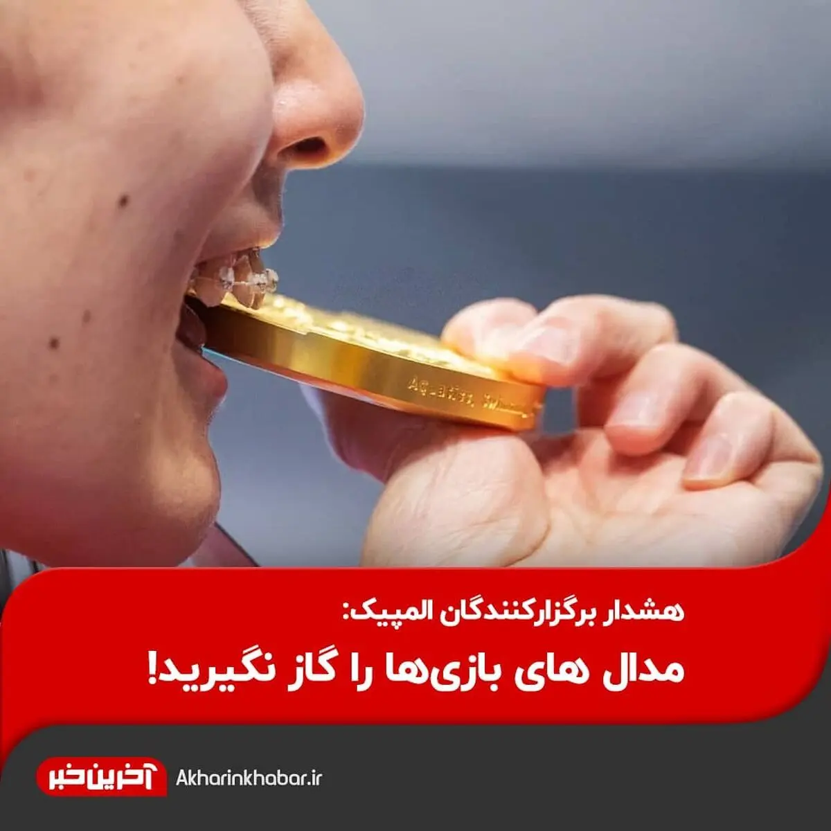  مدال های بازی‌ها را گاز نگیرید!
