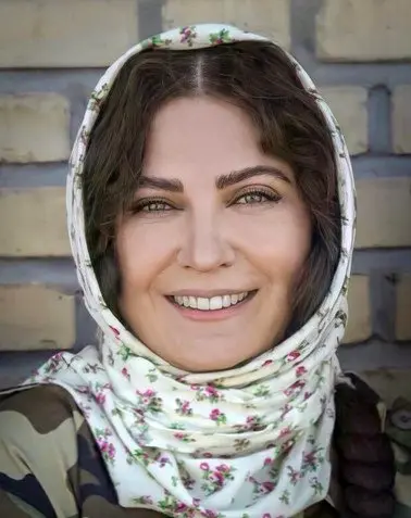 تغییر چهره باورنکردنی لعیا زنگنه همه رو شوکه کرد | خانم کوبید از نو ساخت