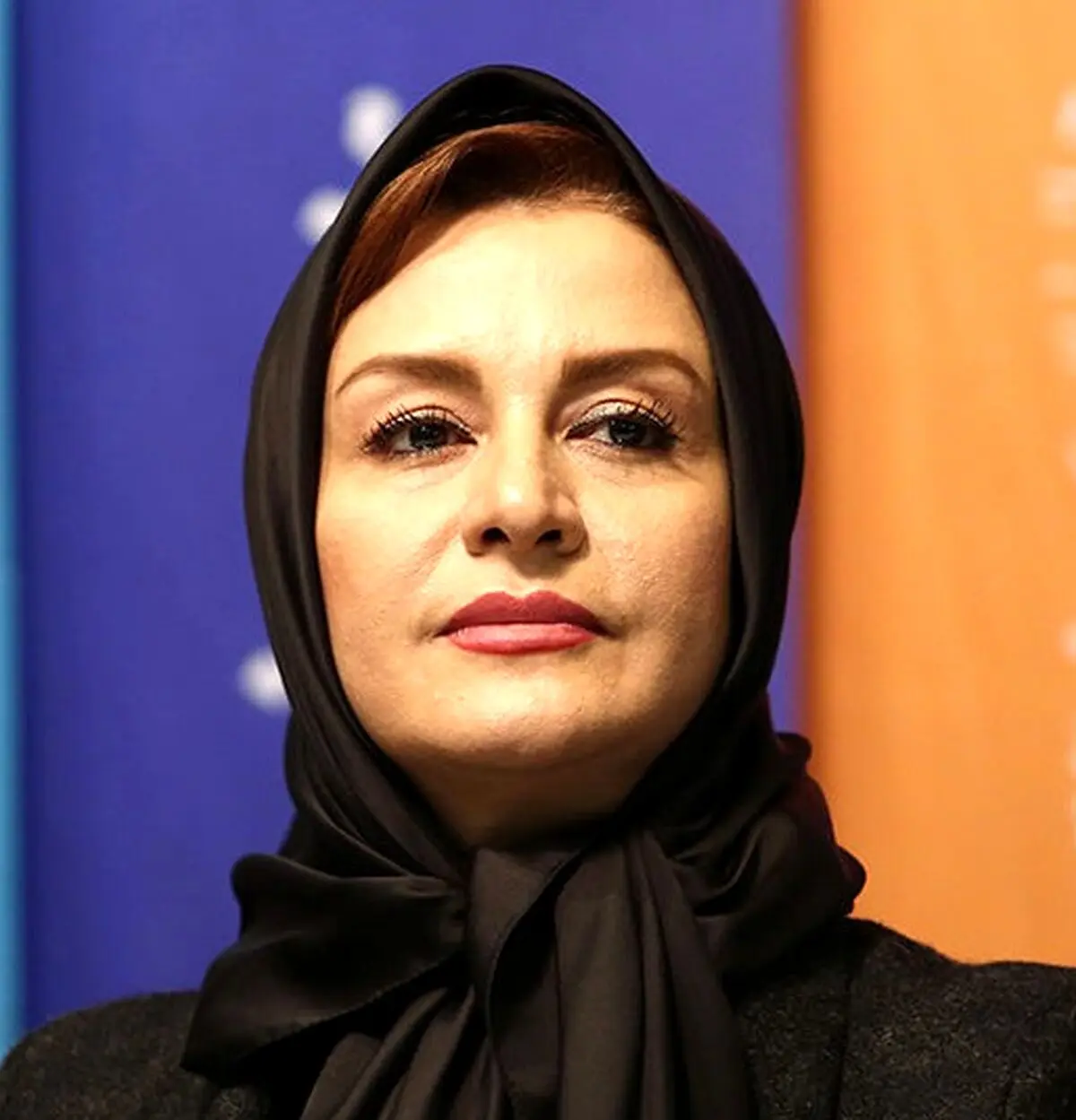 مریلا زارعی کوبید از نو ساخت | مریلا زارعی یا عمل زیبایی 20 سال جوانتر شد