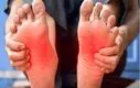 ۵ دلیل شایع داغ شدن کف پا | این درمان‌های خانگی را امتحان کنید