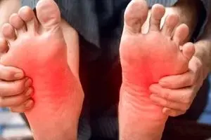 ۵ دلیل شایع داغ شدن کف پا | این درمان‌های خانگی را امتحان کنید