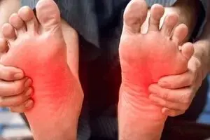 ۵ دلیل شایع داغ شدن کف پا | این درمان‌های خانگی را امتحان کنید