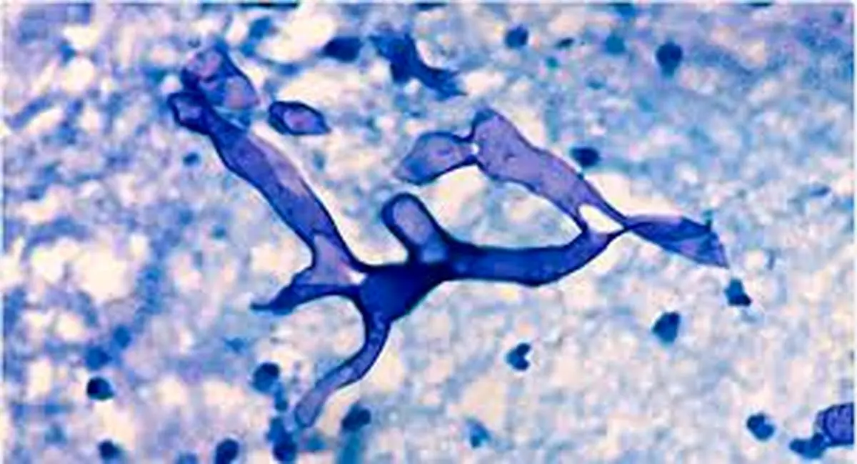 توضیح وزارت بهداشت راجب به قارچ سیاه