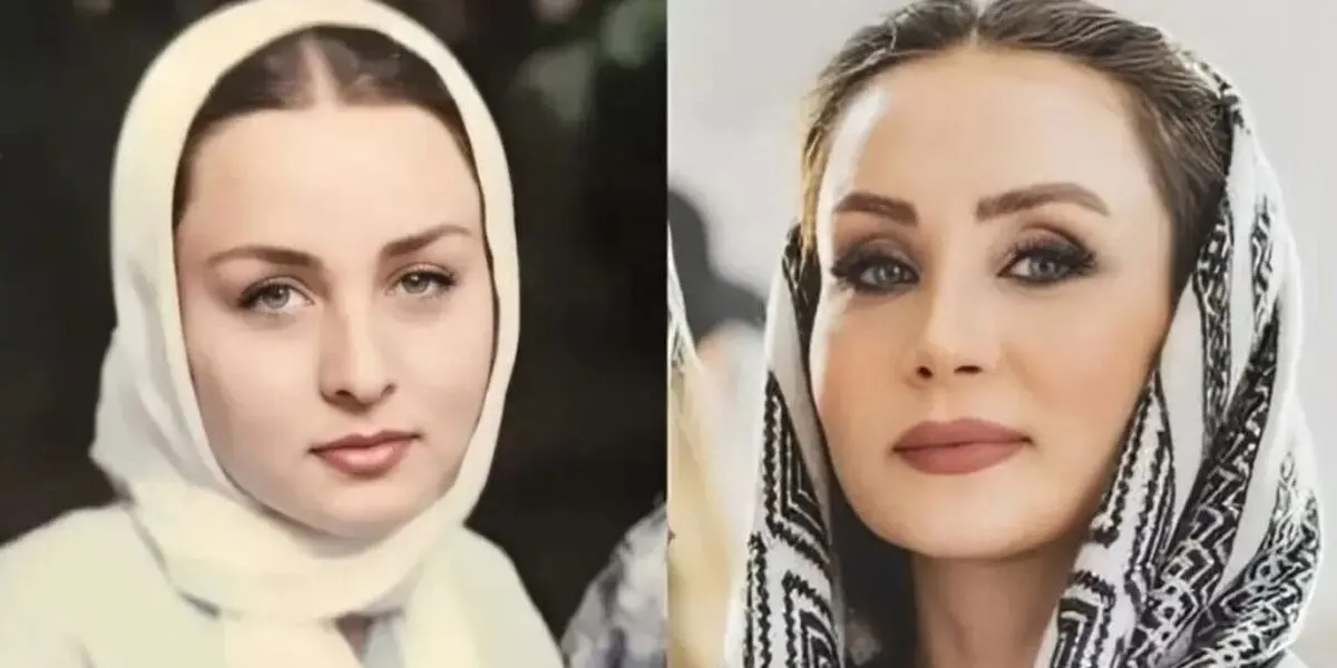 لیست عمل های زیبایی حدیث فولادوند در ۴۷ سالگی | دروغ حدیث فولادوند لو رفت ! + عکس