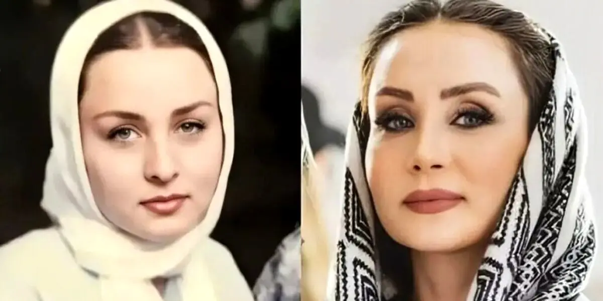 لیست عمل های زیبایی حدیث فولادوند در ۴۷ سالگی | دروغ حدیث فولادوند لو رفت ! + عکس