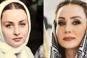 لیست عمل های زیبایی حدیث فولادوند در ۴۷ سالگی | دروغ حدیث فولادوند لو رفت ! + عکس