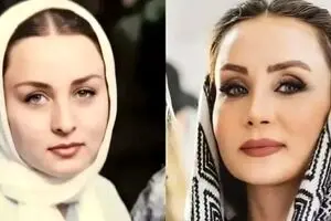 لیست عمل های زیبایی حدیث فولادوند در ۴۷ سالگی | دروغ حدیث فولادوند لو رفت ! + عکس