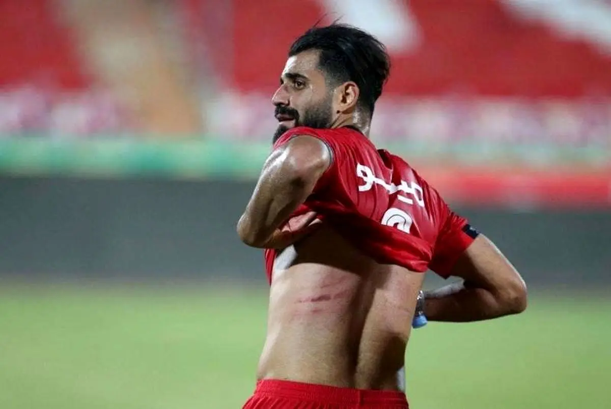 رد استوک بر بدن مدافع پرسپولیس؛ زخم کاری!
