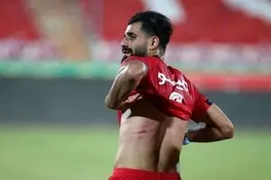 رد استوک بر بدن مدافع پرسپولیس؛ زخم کاری!