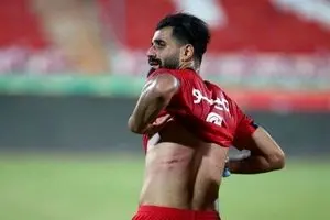 رد استوک بر بدن مدافع پرسپولیس؛ زخم کاری!