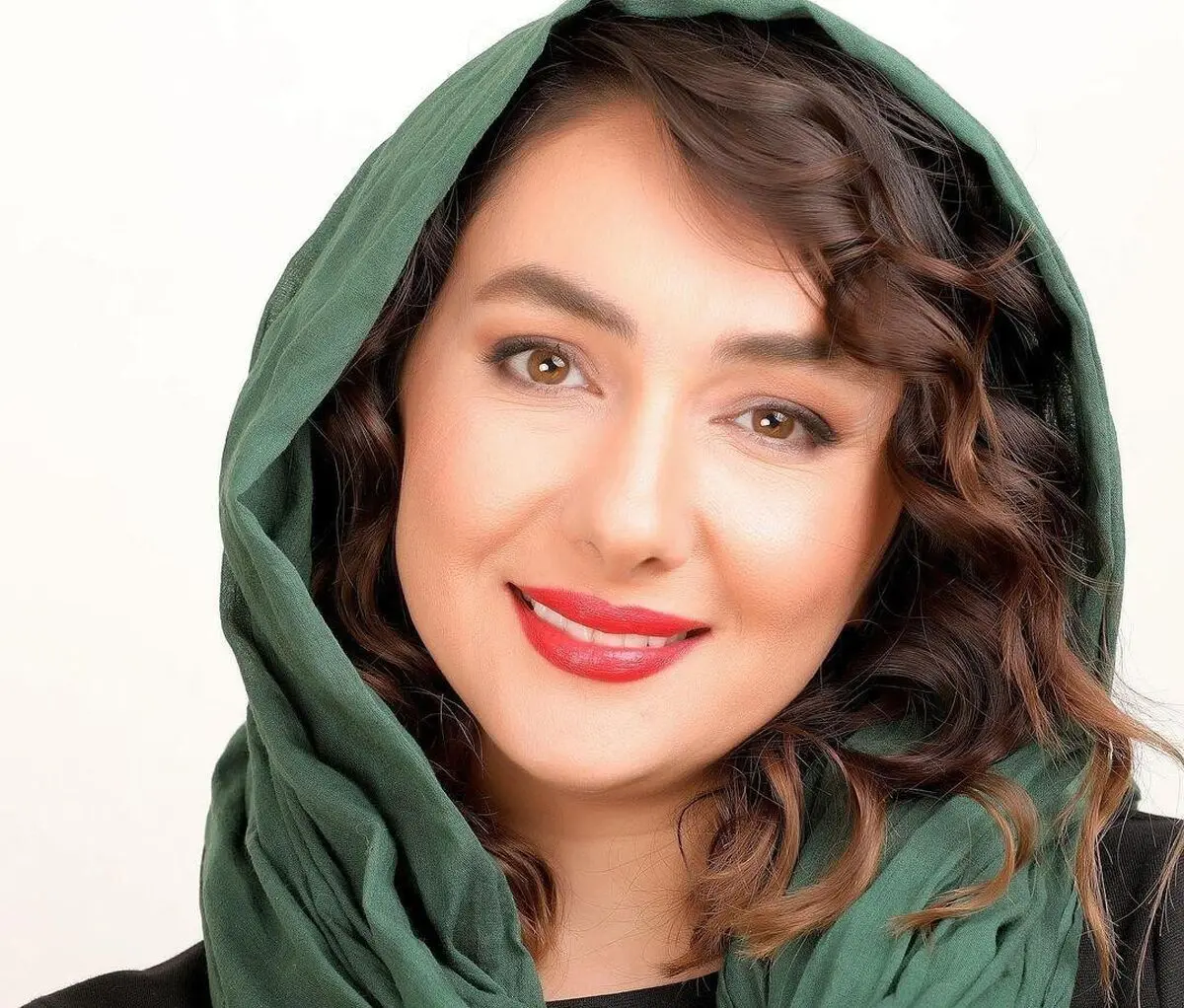 بیماری پوستی هانیه توسلی چهره اش را داغون کرد