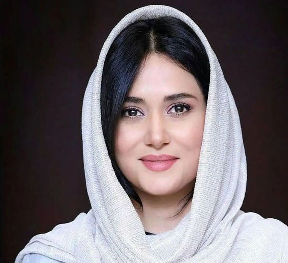 چه بلایی بر سر پریناز ایزدیار آمده است | تغییر چهره عجیب و باورنکردنی پریناز ایزدیار 
