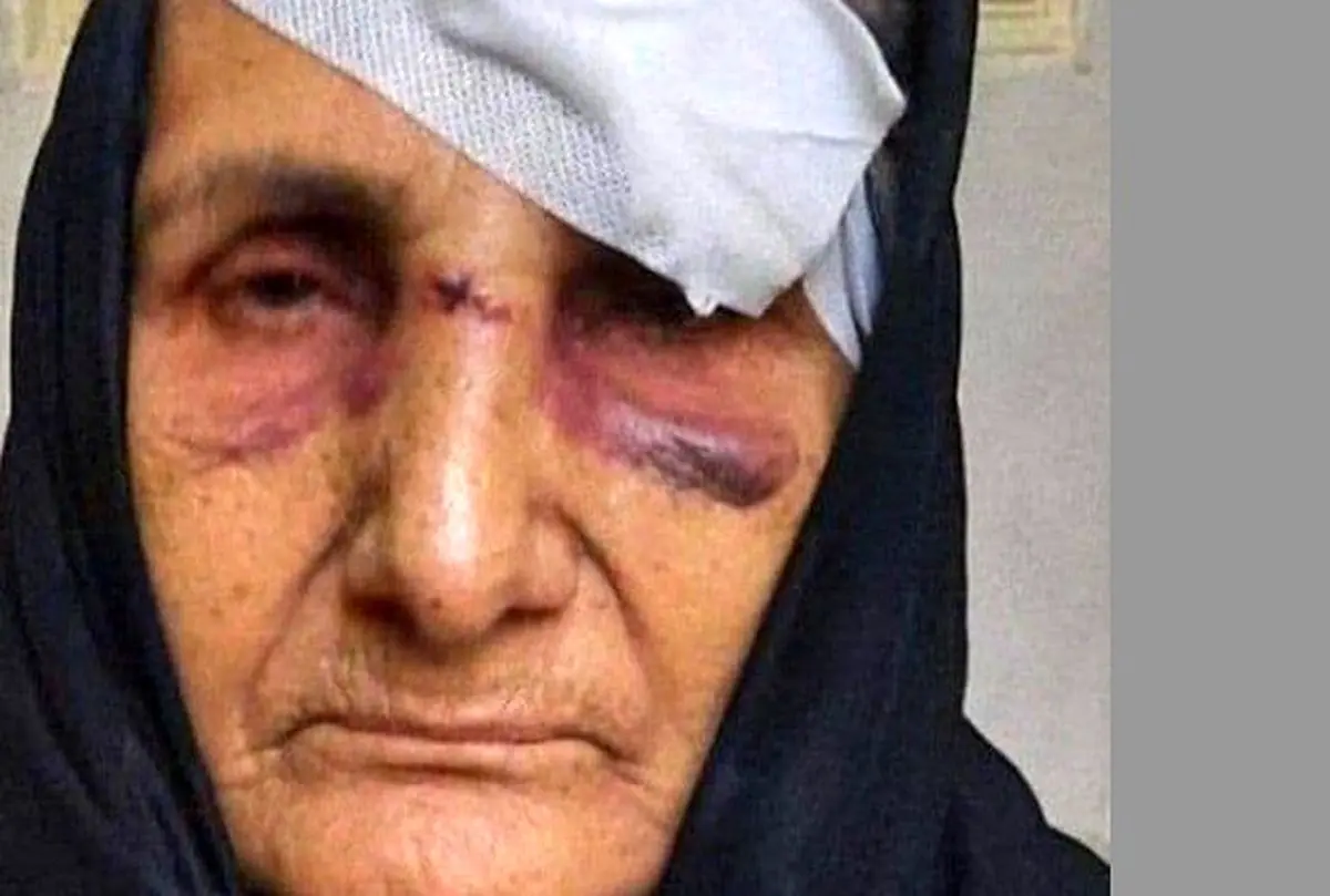 پشت پرده ضرب و شتم گوهر عشقی فاش شد | اولین واکنش رسمی دولت به ماجرای گوهر عشقی