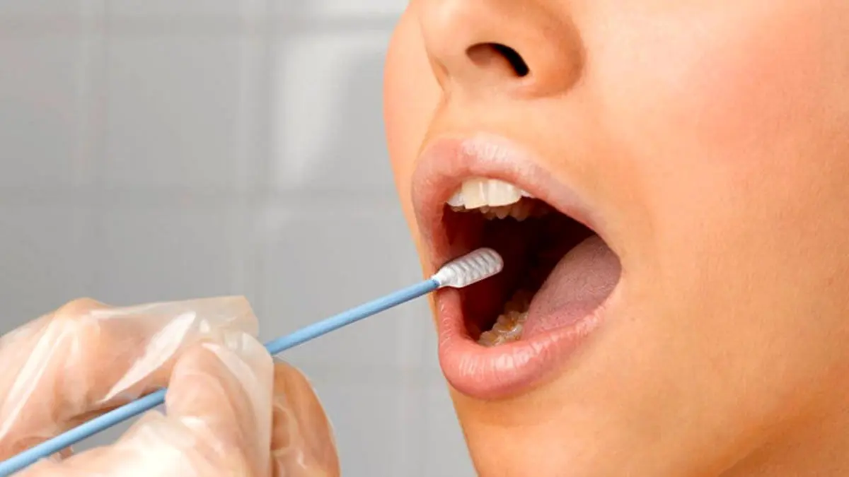 علت خشکی دهان چیست؟