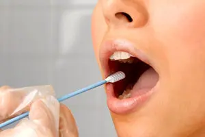 علت خشکی دهان چیست؟