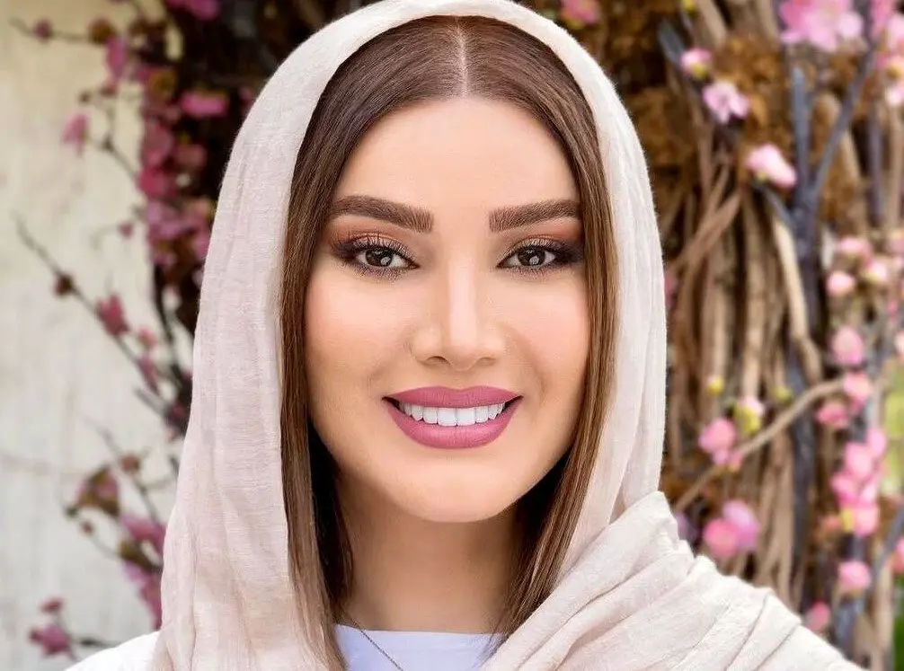 لیست تمام عمل های زیبایی متین ستوده | تغییر چهره باورنکردنی تازه عروس سینمای ایران + تصاویر