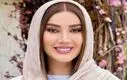 لیست تمام عمل های زیبایی متین ستوده | تغییر چهره باورنکردنی تازه عروس سینمای ایران + تصاویر