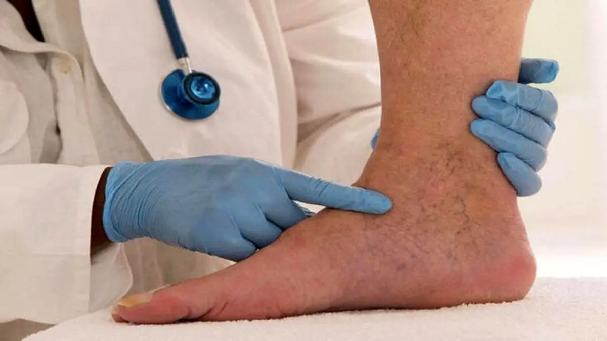 چه افرادی نباید قرص ضد بارداری مصرف کنند؟