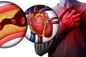 این غذاها قاتل خاموش سلامت انسان اند !