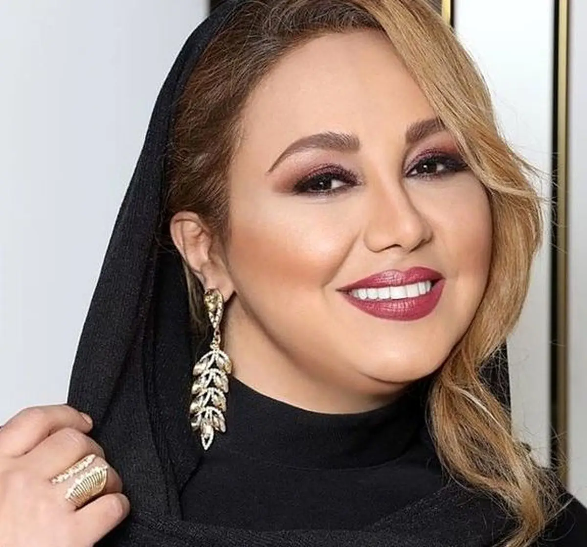 حادثه وحشتناک برای بهنوش بختیاری | بهنوش بختیاری در آتش سوخت