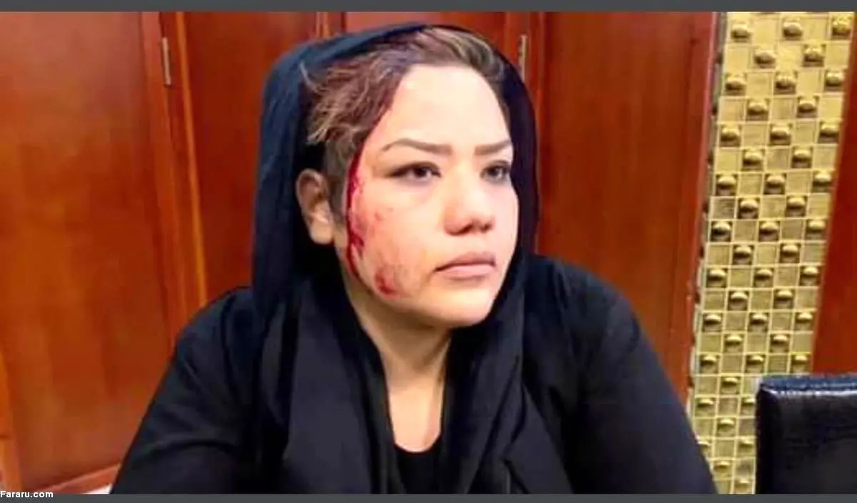 به خون افتادن یک زن افغان بر اثر ضرب و شتم طالبان