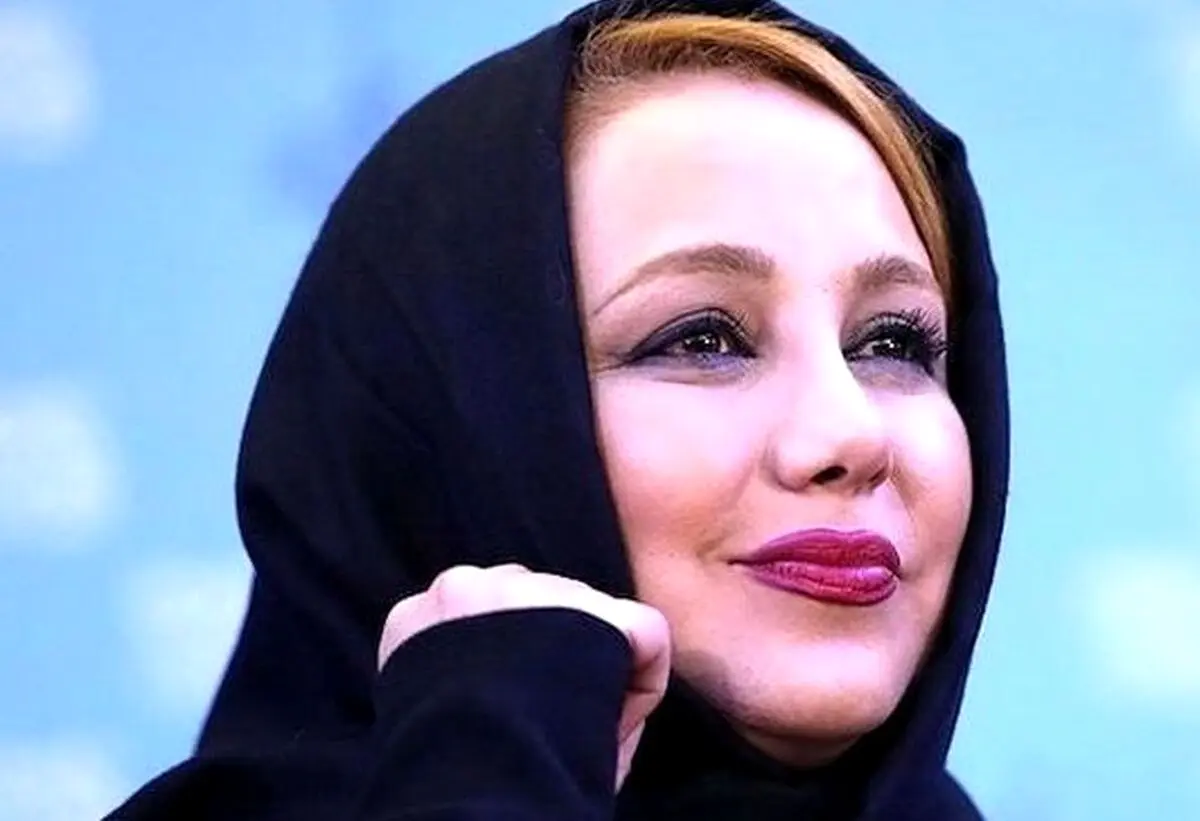 بهنوش بختیاری زمین تا آسمان تغییر کرد | چهره وحشتناک بهنوش بختیاری 
