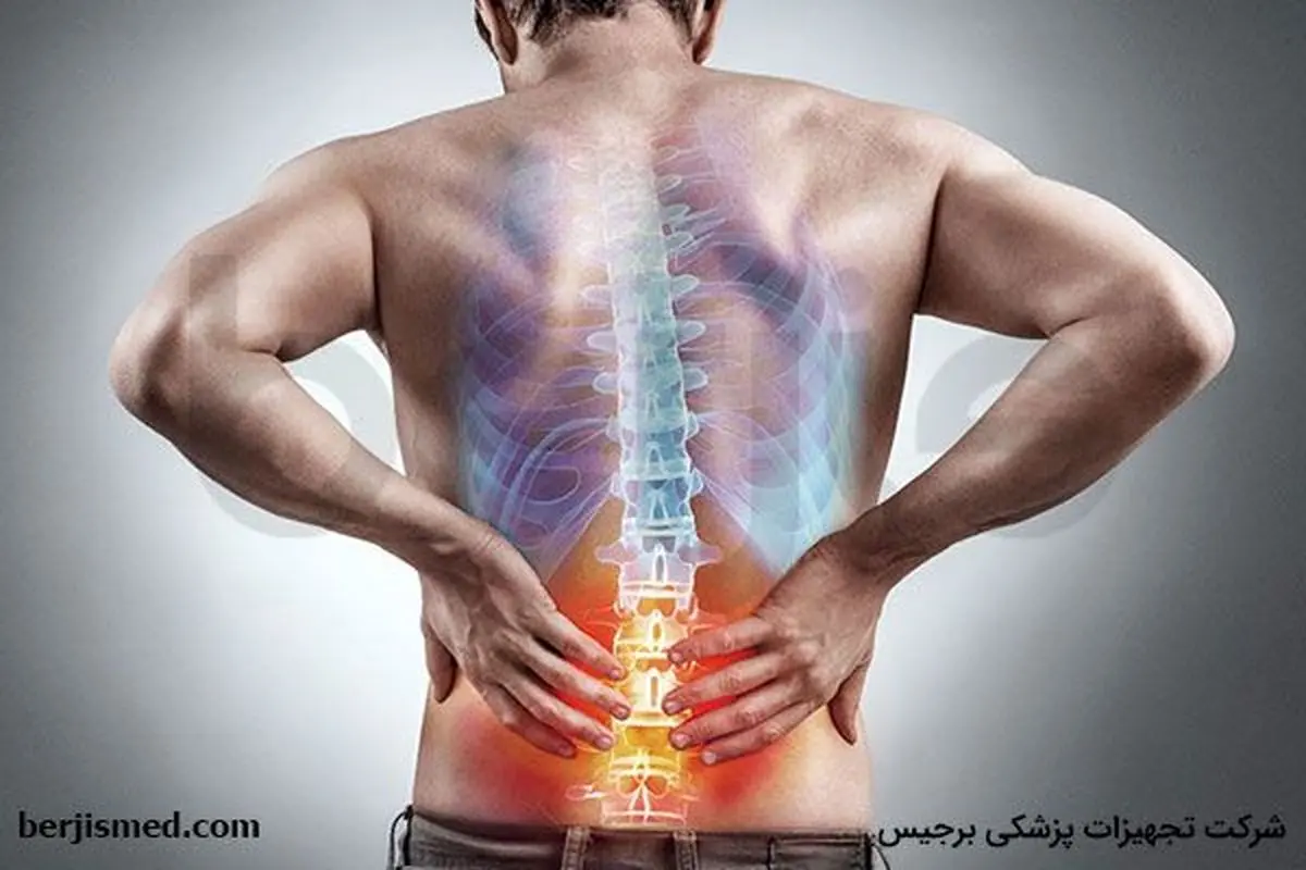 درمان درد سیاتیک با داروهای شل کننده عضلانی